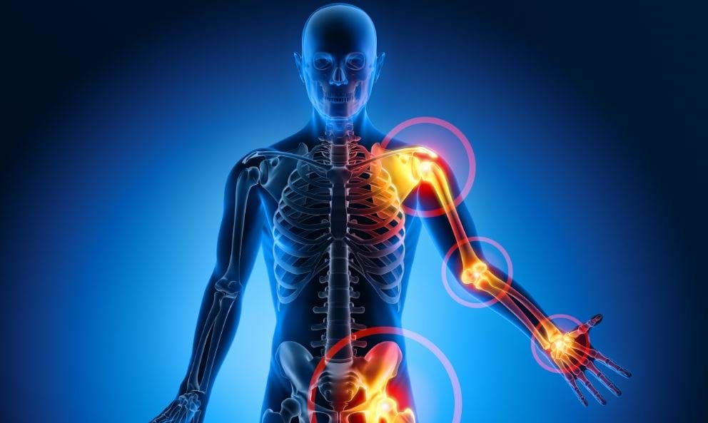 Osteoarthritis and Exercise: Why (and How) You Should Keep Moving